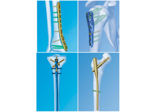 Trauma Services in Aligarh